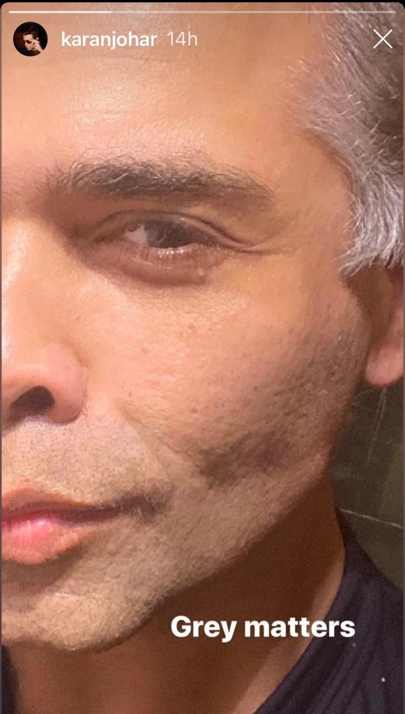 Karan proudly flaunts his greys.