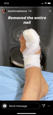 Karishma Tanna has a toe nail surgery amid lockdown.
