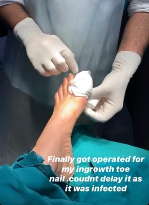Karishma Tanna has a toe nail surgery amid lockdown.