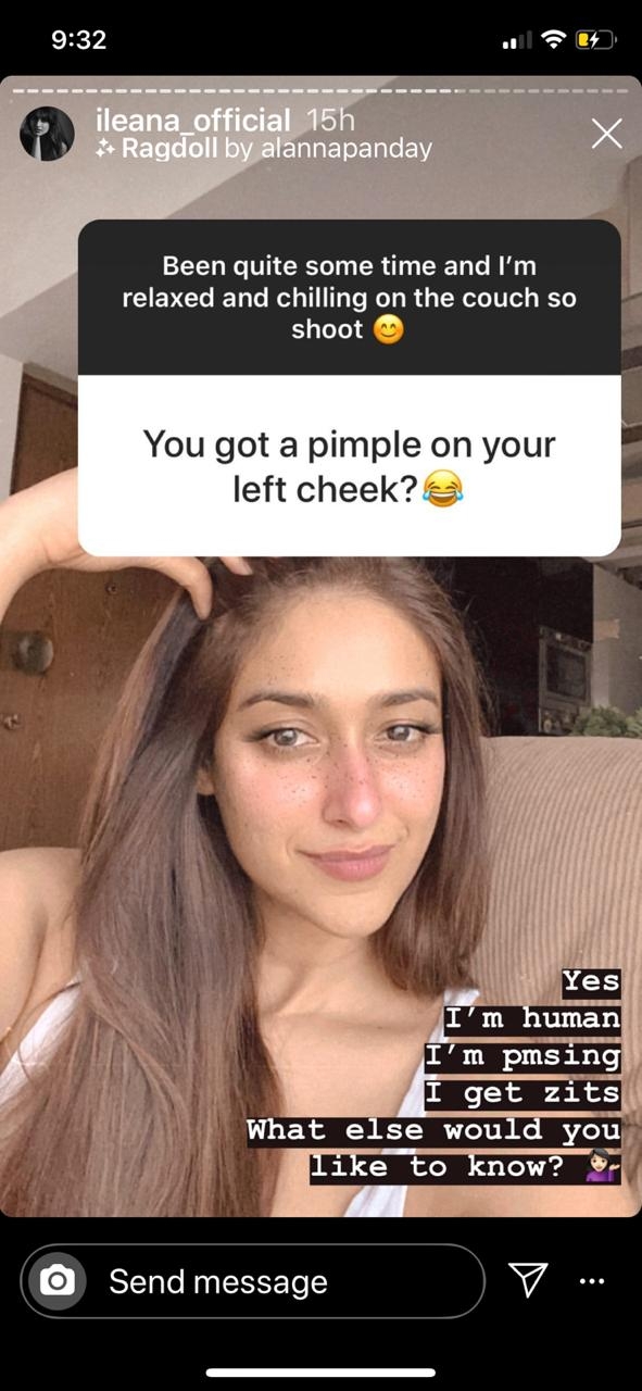 Ileana D'cruz: Yes I'm human, I get zits.