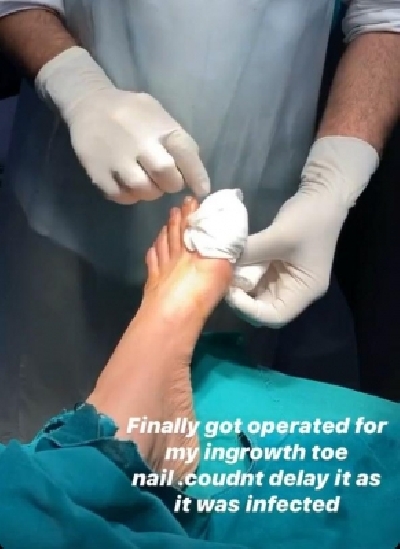 Karishma Tanna has a toe nail surgery amid lockdown.