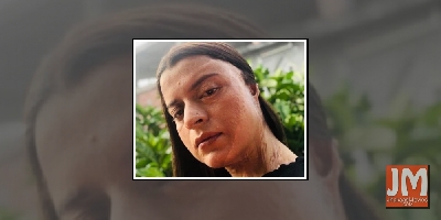 Acid attack survivor Rangoli: Parents would see my face and faint